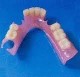 servicio tecnico dental  protesis dentales  flexibles