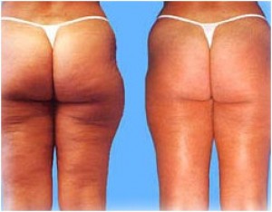 claudia Gallo Turismo en Chile en Providencia |  Masaje Reductivo,drenaje linf&aacute;tico post operatorio, Drenaje linf&aacute;tico, ultrasonido